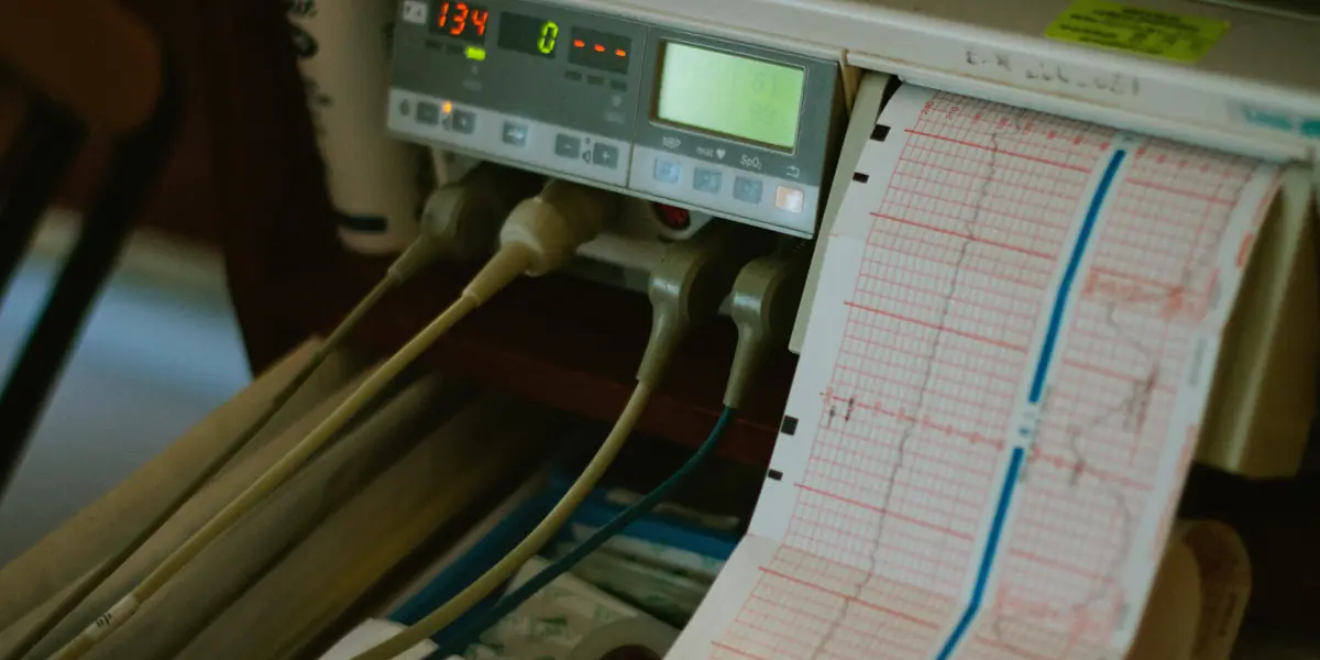 Patiëntmonitor die een hartritme- en CTG-registratie op papier afdrukt